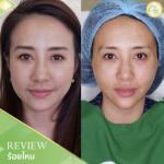 ร้อยไหม เชียงราย - บริษัท ชิค คลินิก จำกัด 