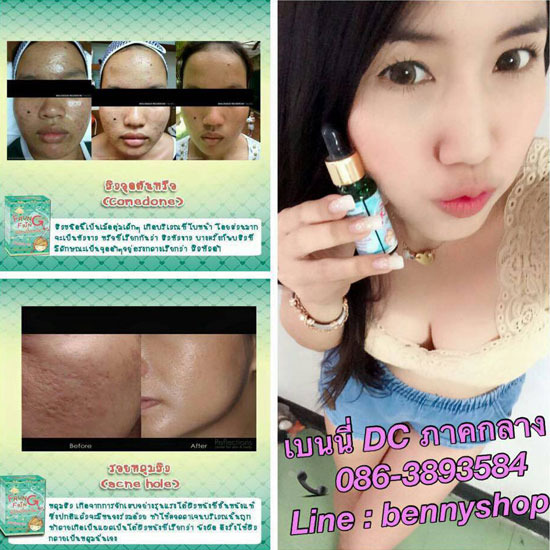 	ฟรุ้งฟริ้ง เซรั่ม (เพชรฆาตหน้าปลวก) ครีมบำรุงผิวหน้า 